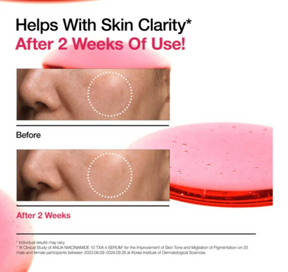 Anua Niacinamide 10% + TXA 4% Dark Spot Serum