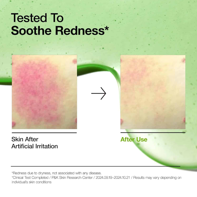 ANUA Azelaic Acid 10% + Hyaluron Redness Soothing Serum